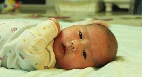 Ӥ��ʪ��������Ʒ��� ����ʪ���ע������